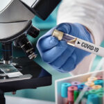 Scientist holding COVID-19 vial near microscope.