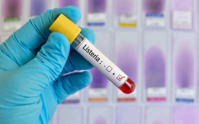 shutterstock_1041103306.jpg Listeria positive test tube