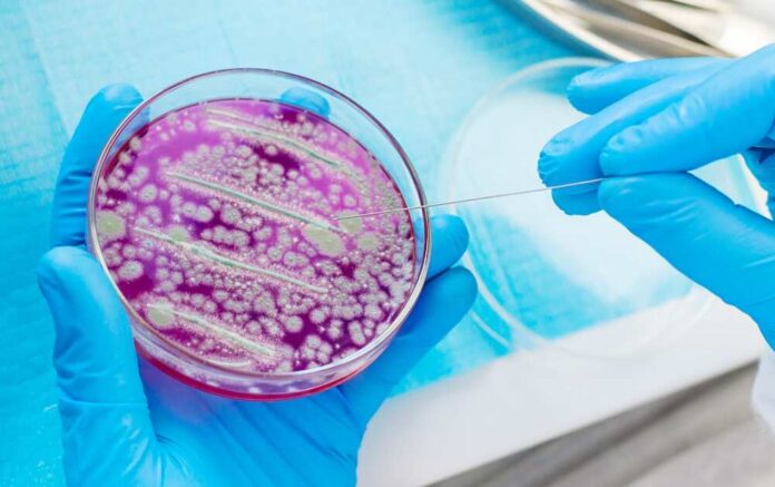 Scientist using a sterile tool to manipulate bacterial culture in a petri dish